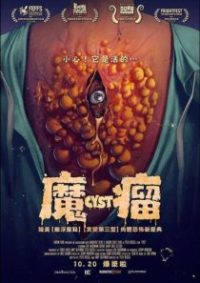 囊肿 poster